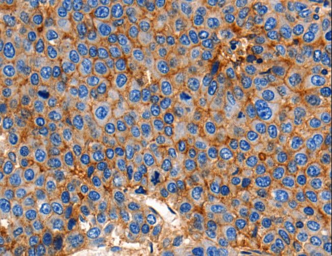 Polyclonal Rabbit anti-Human CLDN1 / Claudin 1 Antibody (IHC, WB)