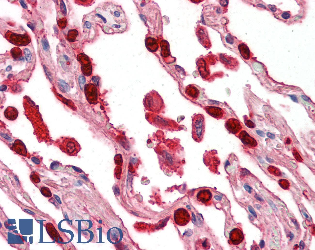 IHC-plus™ TNFSF13 / APRIL Antibody