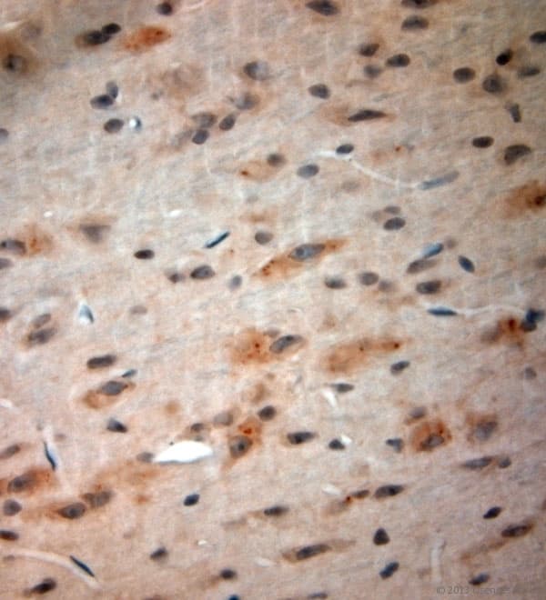 CACNA2D1 Antibody (aa600-650)