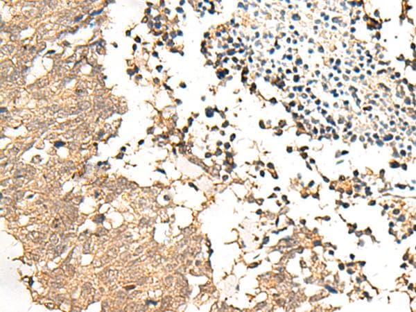 SLC9A1BP / CHP Antibody
