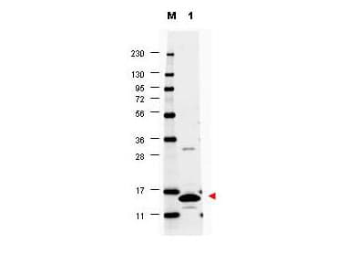 CSF2 / GM-CSF Antibody