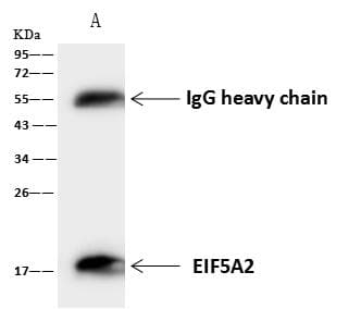EIF5A2 Antibody (Preservative Free)