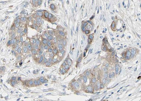 BAD Antibody (phospho-Ser136)