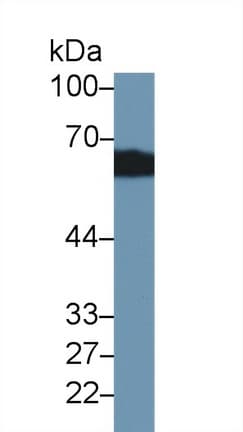 SERPINA6 / CBG Antibody (aa106-255)