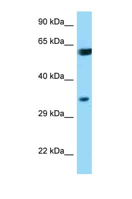 BAG1 / BAG-1 Antibody (aa112-161)