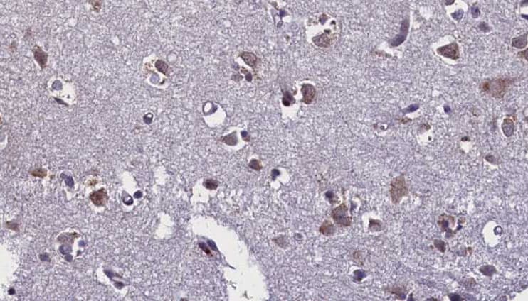 TLR7 / CD287 Antibody