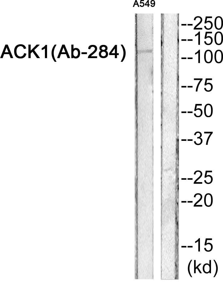 Polyclonal Rabbit anti-Human TNK2 / ACK1 Antibody (Ab-284, WB)
