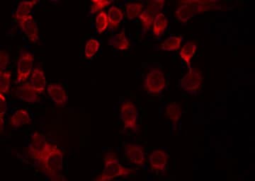 SURF1 Antibody