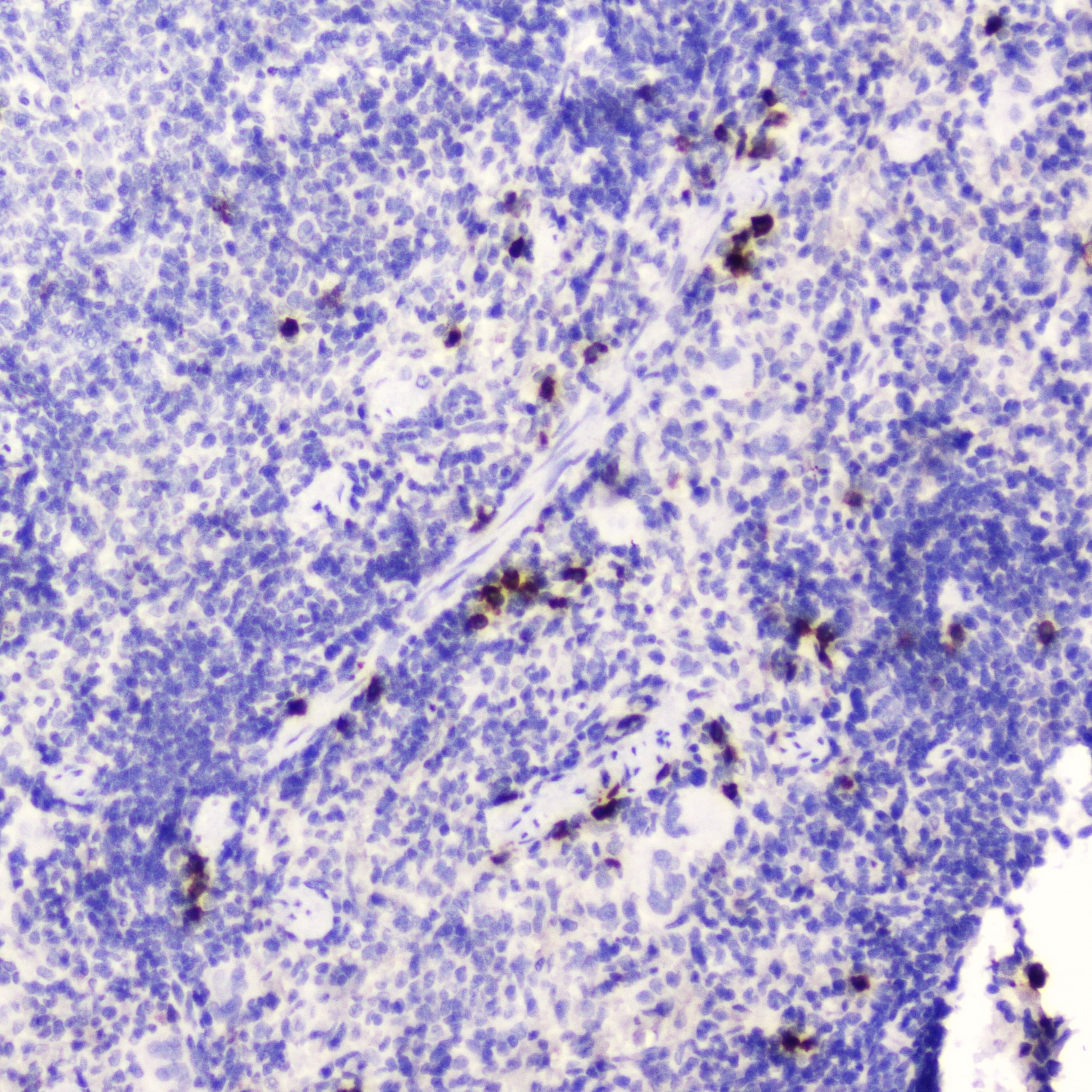 WFDC2 / HE4 Antibody