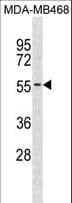 KCNK6 / TWIK-2 Antibody (aa263-292)