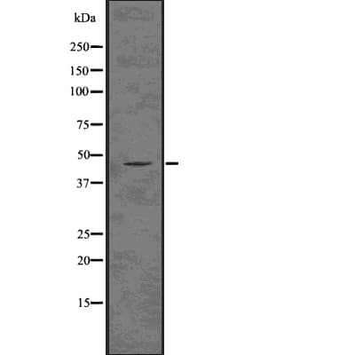 DCX / Doublecortin Antibody