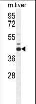 Polyclonal Rabbit anti-Human SAHH / AHCY Antibody (aa79-110, IHC, WB)