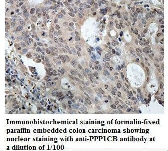 Polyclonal Rabbit anti-Human PPP1CB Antibody (aa30-319, IHC, WB)