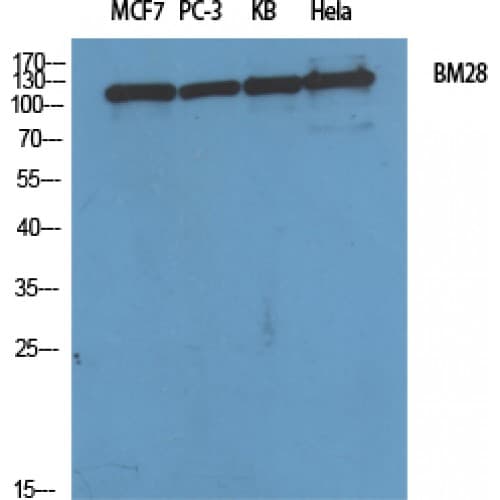 Polyclonal Rabbit anti-Human MCM2 Antibody (1-80 aa, N-terminal, IHC, IF, WB)