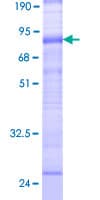 Human SLC38A3 / SNAT3 Protein (Recombinant GST)