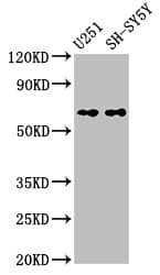 Polyclonal Rabbit anti-Rat NOX4 Antibody (WB)