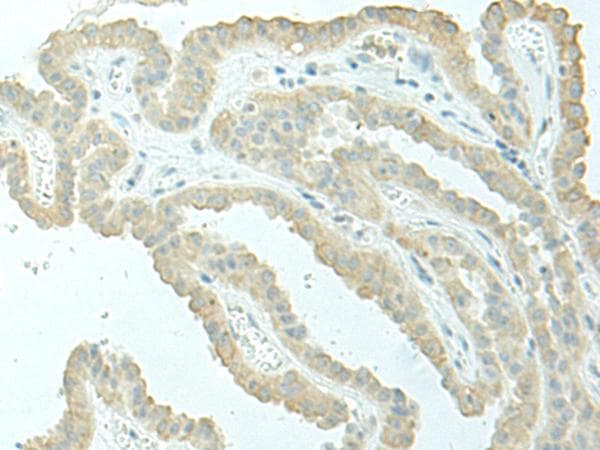 Polyclonal Rabbit anti-Human EVI2B Antibody (IHC)