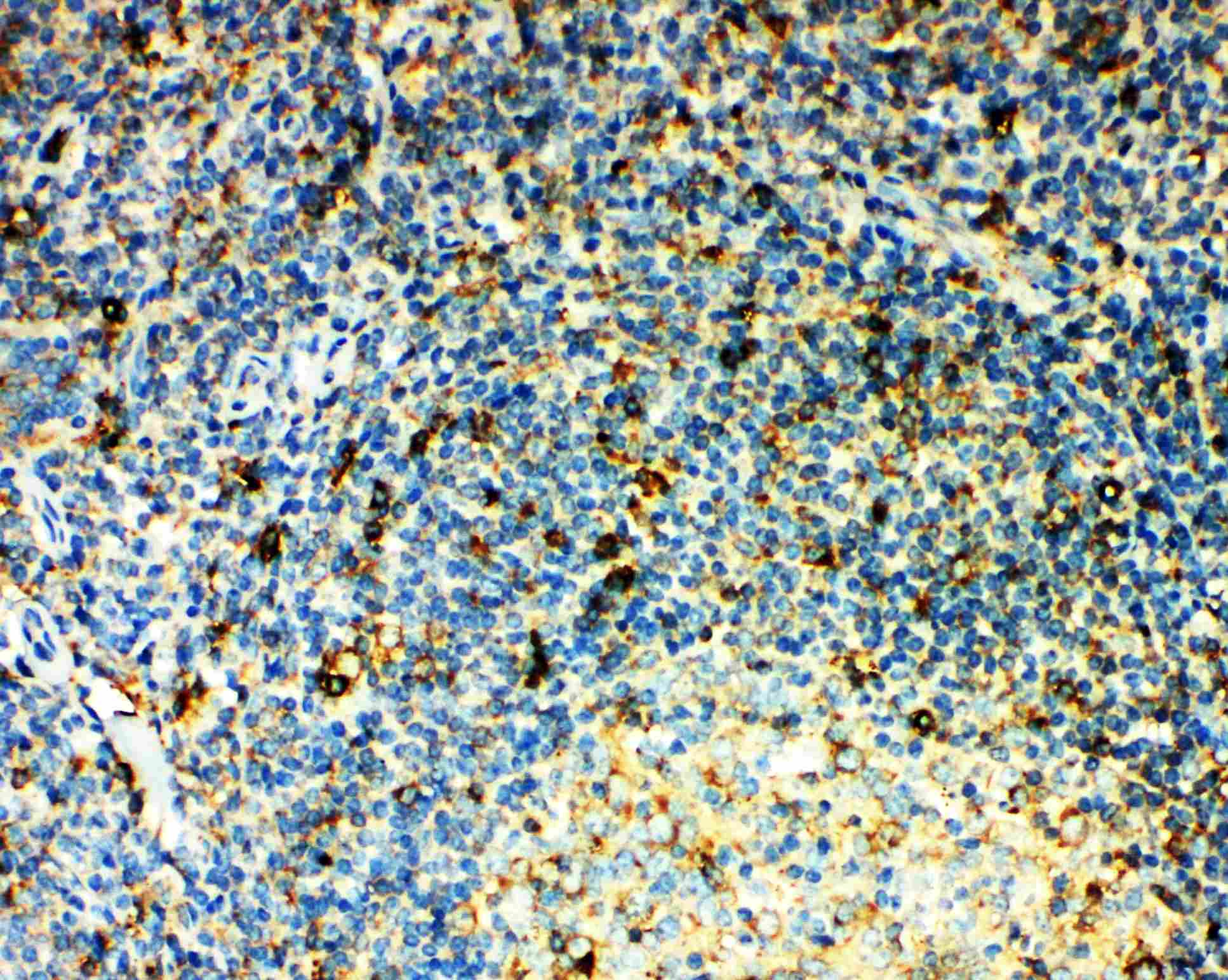 Polyclonal Rabbit anti-Human CCR3 Antibody (aa1-20, IHC, WB)