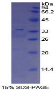 Human ABCA3 Protein (Recombinant His-T7)