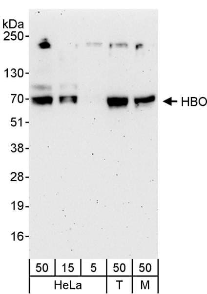 MYST2 / HBO1 Antibody (aa125-175)