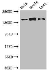 Polyclonal Rabbit anti-Human SULF2 / Sulfatase 2 Antibody (IHC, IF, WB)