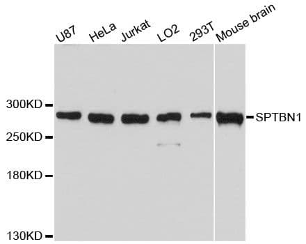 Polyclonal Rabbit anti-Human SPTBN1 / ELF Antibody (WB)