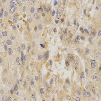 Polyclonal Rabbit anti-Human UCP3 Antibody (IHC, IF, WB)
