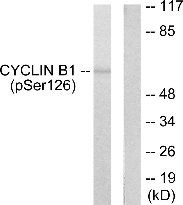 Polyclonal Rabbit anti-Human CCNB1 / Cyclin B1 Antibody (phospho-Ser126, IHC, WB)