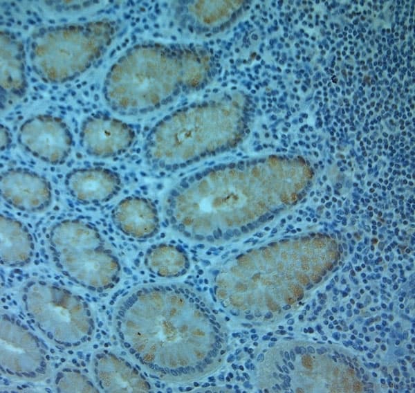 SLC11A2 / DMT1 Antibody