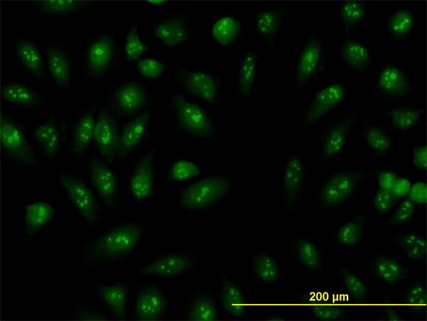 RRP9 Antibody (clone 1E8)
