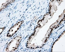 APP / Beta Amyloid Precursor Antibody (clone OTI7B8)
