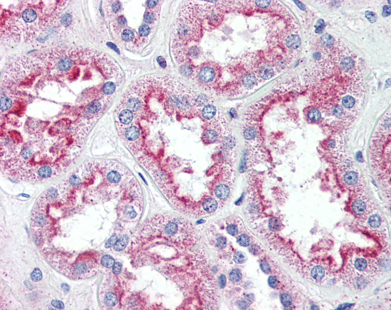 IHC-plus™ Polyclonal Rabbit anti-Human SLC5A11 / SMIT2 Antibody (Internal, IHC)