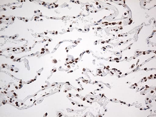 EWSR1 / EWS Antibody (aa256-447, clone OTI2D9)
