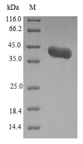 Candida albicans ALS3 Protein (Recombinant 10His-B2M, N-terminus + Myc, C-terminus)