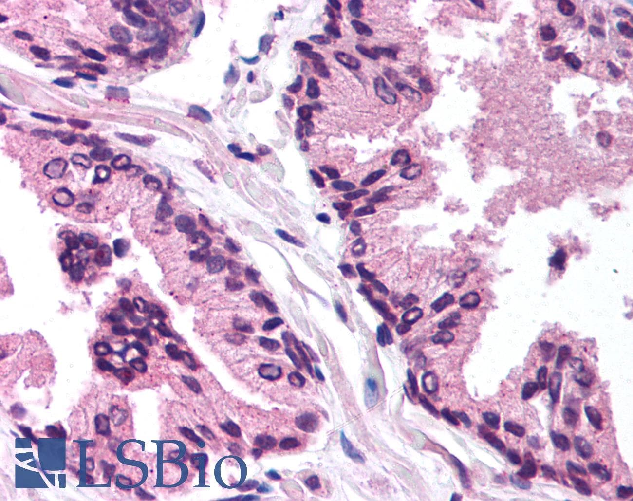 ARA55 / HIC-5 Antibody (aa179-228)