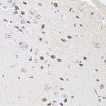 DMAP1 Antibody (AP)