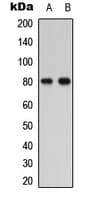 PTHR / PTHR1 Antibody (phospho-Thr1)