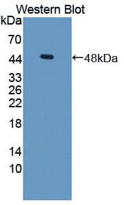 NTRK2 / TRKB Antibody (aa32-430)