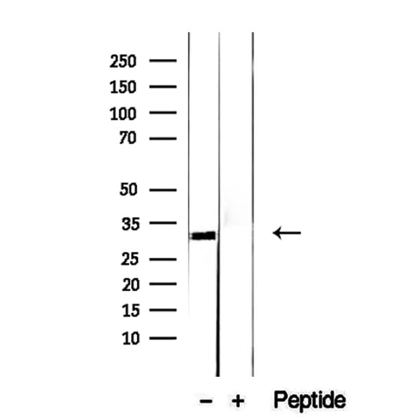 EXOSC3 Antibody