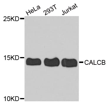 CALCB Antibody