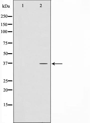CTU1 Antibody