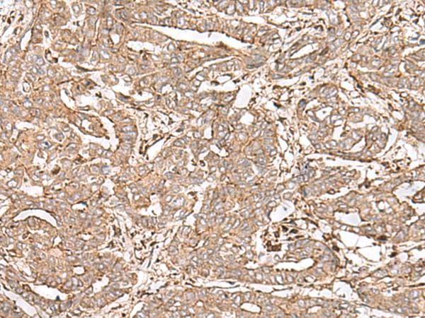 Polyclonal Rabbit anti-Human FAAP24 Antibody (IHC)