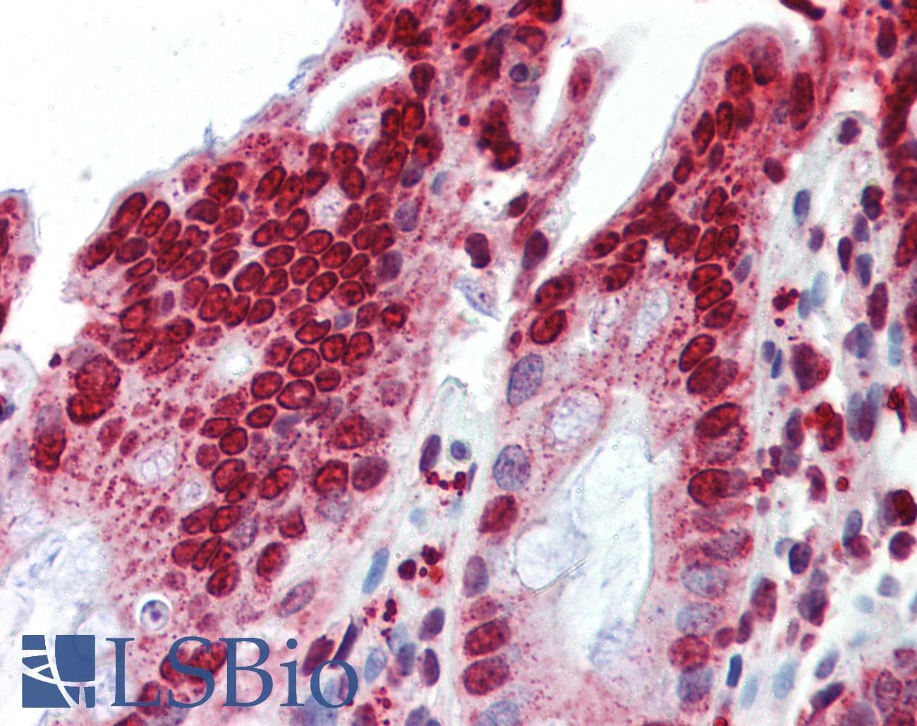 Polyclonal Rabbit anti-Human BXDC5 / RPF1 Antibody (aa45-94, IHC, WB)