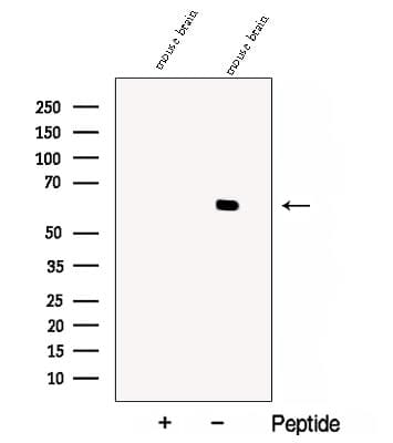 Polyclonal Rabbit anti-Human DPYSL5 / CRMP5 Antibody (IF, WB)