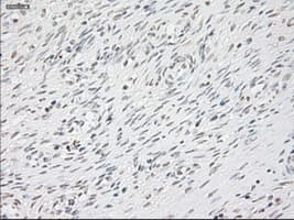 Monoclonal Mouse anti-Human GFAP Antibody (clone OTI5D7, IHC, WB)