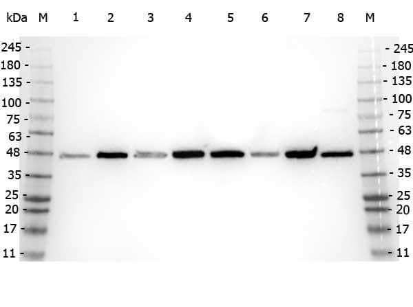 APP / Beta Amyloid Precursor Antibody