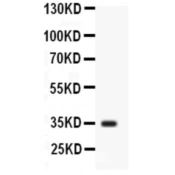 ARG1 / Arginase 1 Antibody (aa64-92)