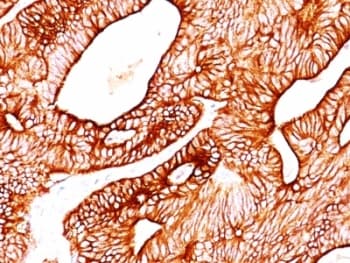 Cytokeratin 5+8 Antibody (clone SPM268, Azide-free, BSA-free)