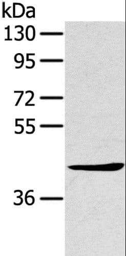 TNIP2 / ABIN-2 Antibody
