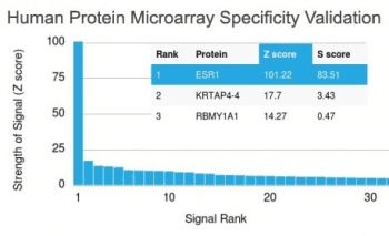 ER Alpha / Estrogen Receptor Antibody (clone ESR1/1935)